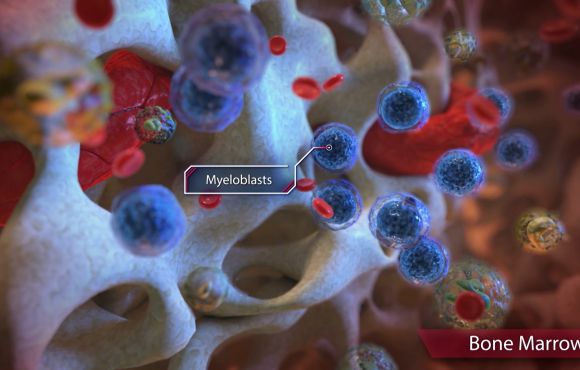 Hematological Cancers